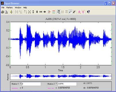189 EK-2 (Devam)Ses Dosyaların Görüntüsü (Au00550)Stego Sese Ait Audio Unitin Analizi (%50 veri gizlenmiş) (Au005100)Stego Sese Ait Audio Unitin Analizi (%100 veri gizlenmiş) (Au005)Orijinal Sese Ait
