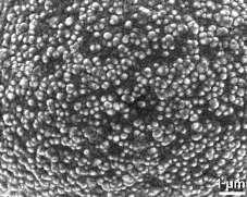 ġekil 41: Skabrat ornamentasyon ıģık mikroskobu görünümü (Paldat, 2015).