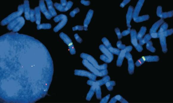 İnsan X-kromozomları Floresan in situ hibridizasyon (FISH) tekniği ile boyanmış.