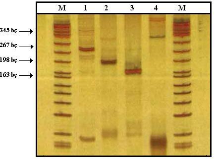 45 % 8 (29:1) lik poliakrilamit jele yüklendi ve 150 V ta 25-30 dakika elektroforez edildi. PCR ürünleri molekül ağırlığı bilinen bir DNA markırı ile analiz edildi.