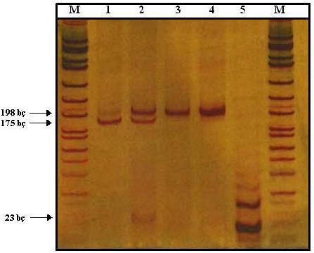 49 Tüm hasta ve kontrol gruplarındaki bireylerin MTHFR1298A>C mutasyonunu için genotipleri belirlendi.
