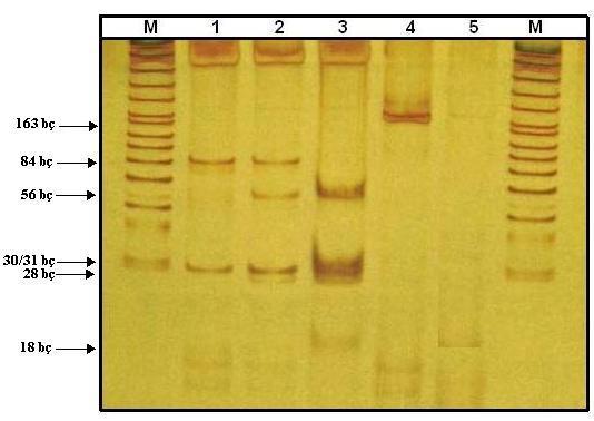50 Şekil 4.5 : MTHFR1298A>C mutasyonunu barındıran gen bölgesi PCR ve kesim ürünlerinin % 12 (19:1) lik poliakrilamit jeldeki görünümleri.