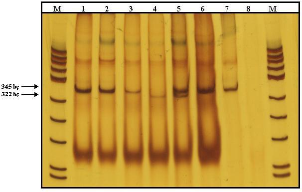 52 Şekil 4.6 : Protrombin20210G>A mutasyonunu barındıran gen bölgesi PCR ve kesim ürünlerinin % 6 (19:1) lık poliakrilamit jeldeki görünümleri.
