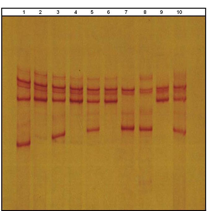 57 Şekil 4.8 : MTHFR1298A>C mutasyonunu barındıran ilgili gen bölgesi PCR ürünlerine ait SSCA çalışması.