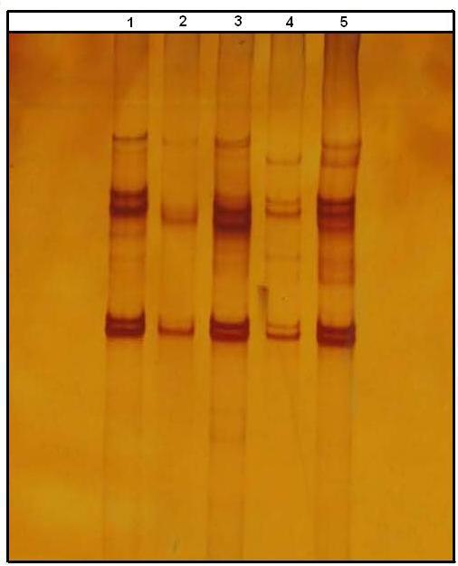 58 Şekil 4.9 : Protrombin20210G>A mutasyonunu barındıran ilgili gen bölgesi PCR ürünlerine ait SSCA çalışması.