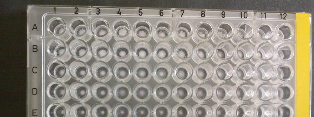 Şekil 5 E. coli O157 Lateks Testi ve değerlendirilmesi.