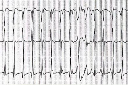 Junctional