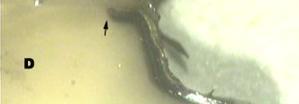 Clearfil SE Bond uygulanmış örneklerde hibrit tabakası boyunca oluşan gümüş sızıntısının Stereomikroskop taki görüntüsü (X40).