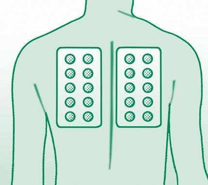 PATCH TEST (YAMA TESTİ) Patch Test; alerjik kontakt dermatit (temas egzaması) denilen egzamanın tanısında kullanılan bir deri testidir.