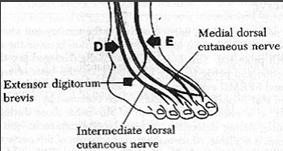 Ayak bileğinde peroneal sinir tuzaklanması Anterior Tarsal Tünel Sendromu (ATTS) Derin peroneal sinirin ayak bileğindeki kompresyonu EDB kasında güç