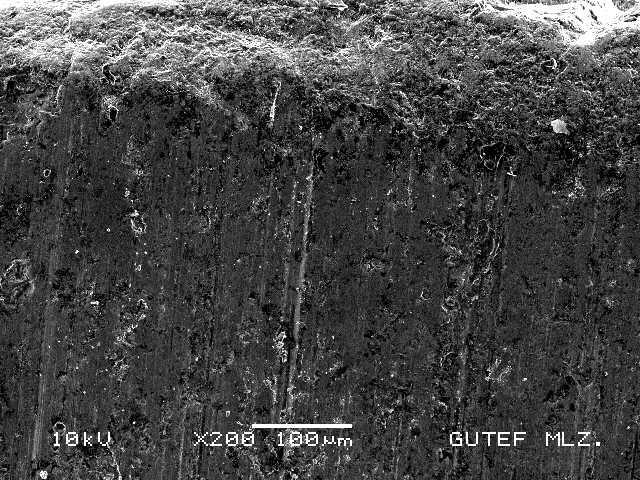 N yük altında aşınmış orta yüzeyinin X 200 büyütmeli görüntüsü. Şekil 8.124.