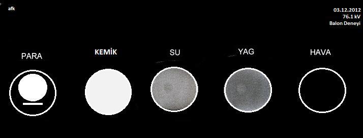 RÖNTGEN FİLMİ ÜZERİNDE DANSİTE FARKLILIĞI Röntgen filmlerinde yaklaşık 16 farklı dansite mevcuttur, dijital röntgende ise dansite 56 farklı tona çıkabilir.