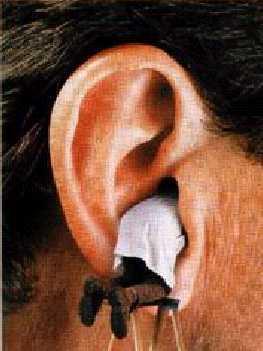 Kulak (Dış ve orta) Otos Otorhinolaryngology