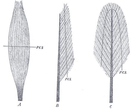 A) Fusiform B)