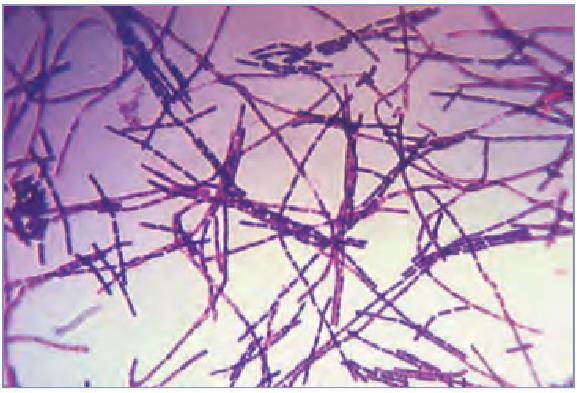 Etiyoloji Bacillus anthracis Aerobik Gram-pozitif Gram