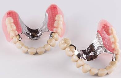 BÖLÜMLÜ PROTEZLER (PARSİYEL PROTEZLER): Kroşeli (Kancalı) Protezler: Diş desteği için, dişin dişetine yakın bombeli alan altında kalan kısmına, kroşe diye