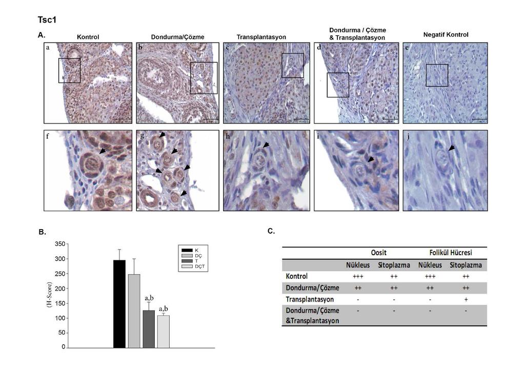 Tsc1 (tuberous