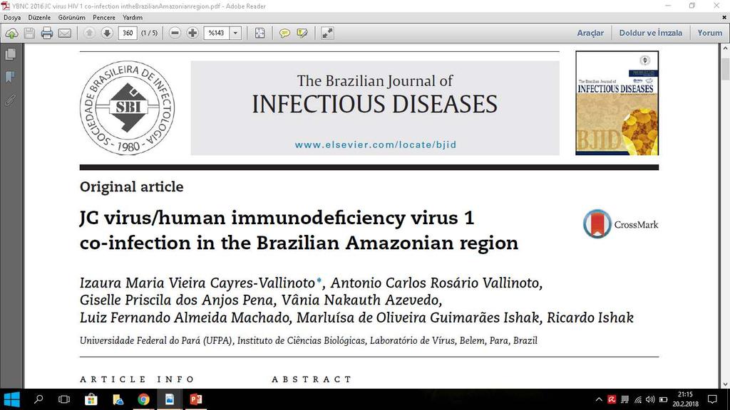 66 HIV-1 (+) hasta 50 ml idrar