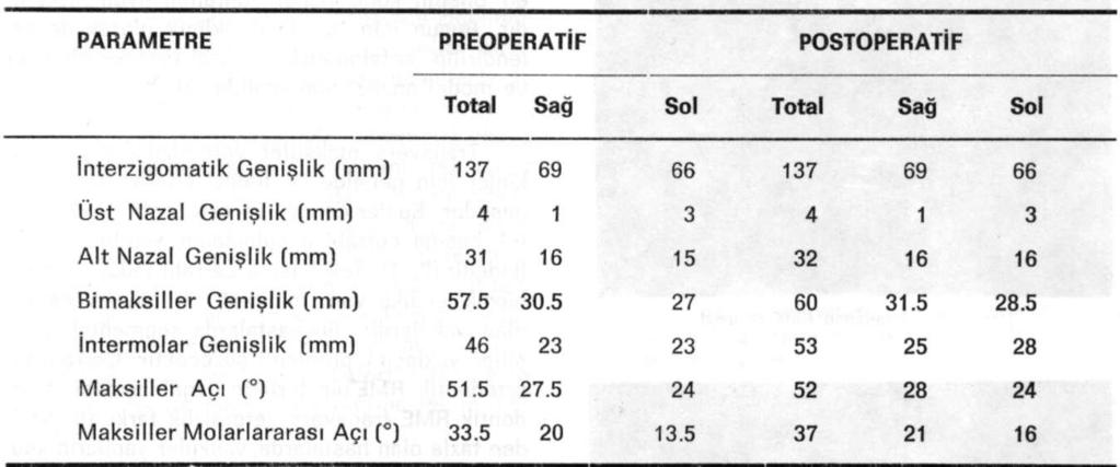 lateral maksiller duvarda apertura priformisten başlayarak pterigomaksiller sutura kadar, Lefort 1 seviyesinde geniş bir kesi hattı yapıldı (Şekil 1).