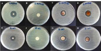 The antibacterial activities of the modified and original PET fibers were given in Table 1 and the agar images of the study were given in Fig. 4.