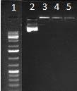 Span 60, Span 80 and Brij 72 niosomes retarded pdna ( Figure 4).