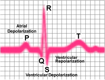 EKG Dalga Biçimi An EKG waveform can be reasonably approximated by four linear functions