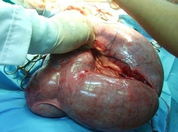 Açık serviks pyometralı bir köpeğin operasyon anındaki uterus görüntüsü D.