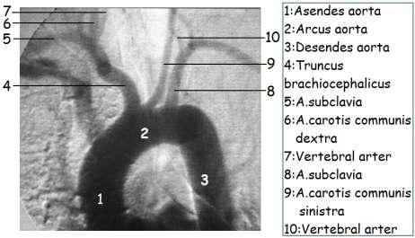 carotis communis dextra A.carotis communis sinistra A.