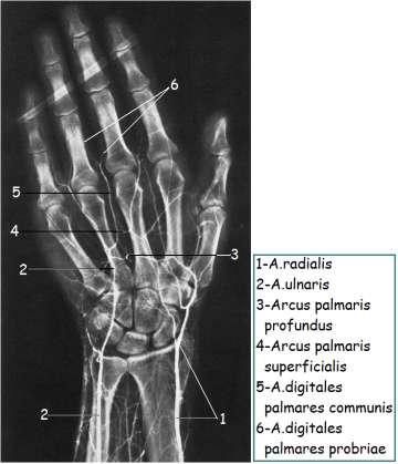 arteriogramı 20: