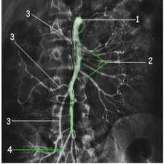 Çöliak arter arteriogramını  Üst mezenterik