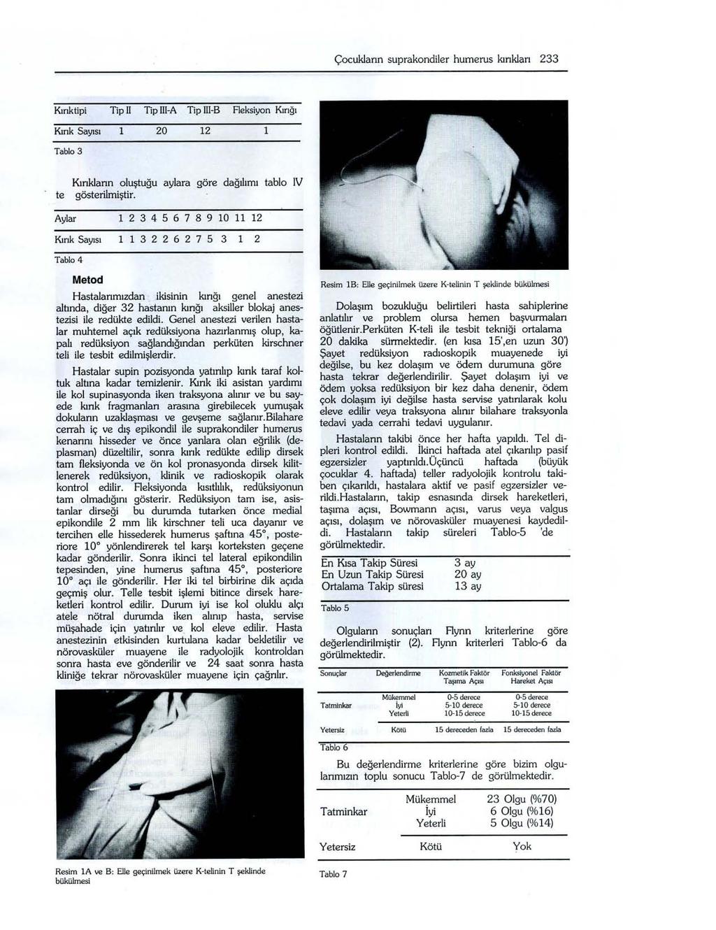 Çocukların suprakondiler humerus kırıkları 233 Kırıktipi Tip II Tip IIl-A Tip LLL-B Reksiyon Kınğı Kırık Sayısı 1 20 12 1 Tablo 3 te Kırıkların oluştuğu aylara göre dağılımı tablo IV gösterilmiştir.