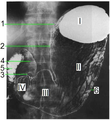 Midenin yüzlerini, eğriliklerini, deliklerini ve bölümlerini resimde gösteriniz. Midenin anatomik yapısını mide modelinde inceleyebilirsiniz. Mide radyogramında anatomik yapıyı gösteriniz.