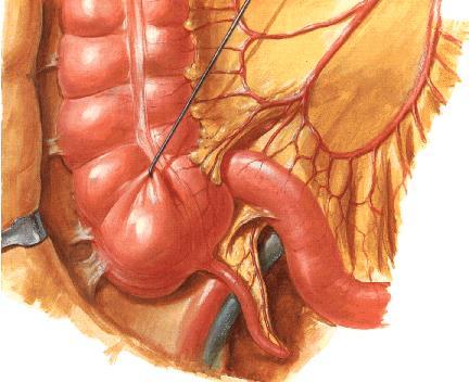 flexura coli sinistra da sonlanır. Yaklaşık 50 cm uzunluktadır. Mesocolon transversum ile karın arka duvarına tutunur.