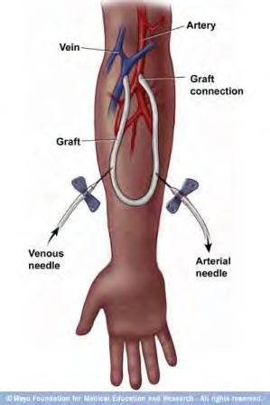 ARTERİO