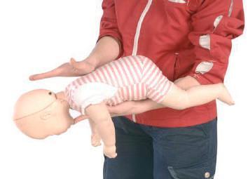 Solunum Yolu Tıkanıklıkları Bebeklerde Tam Tıkanmada İlk Yardım 1. Bebek, ilkyardımcının bir kolu üzerine ters olarak yatırılır, 2.
