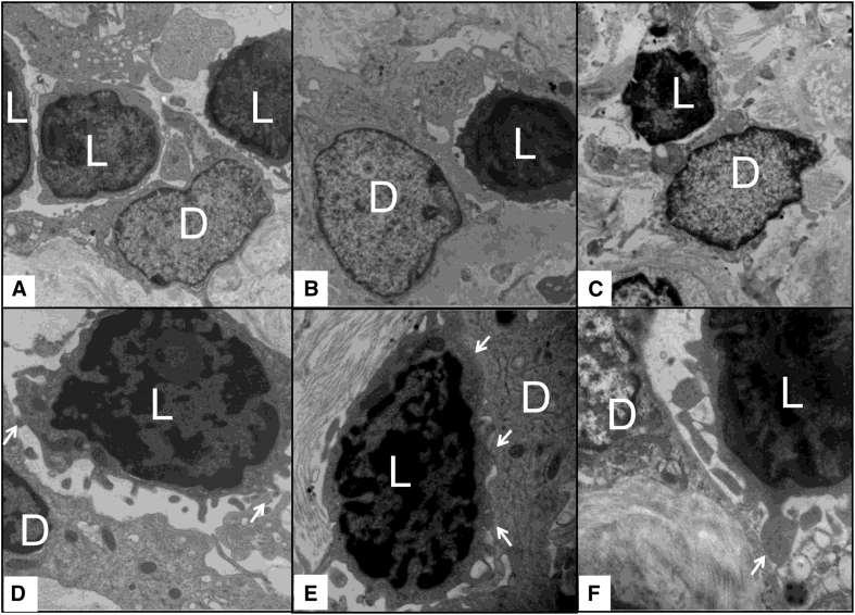 Representative electron microscopy images from six different biopsies with high DC-SIGN+ cell density (>3.