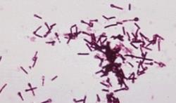 TETANOS Etken: Clostridium tetani, spor