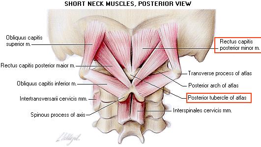 4. M. interspinalis Genel: Segmantal olarak bulunur ( lumbalthoracal-cervical parçaları vardır) Origo: Proc.spinosus lardan Insertio: Proc.