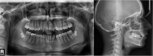 Resim 2: Tedavi başı dental model 