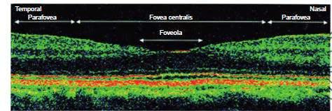 (iç nükleer tabaka) Horizontal hücreler(iç nükleer tabaka) Müller hücreleri Dış limitan membran Konlar Rodlar Retinal pigment epitelyum Koriokapillaris Nörosensoriyel retinanın yapısı.