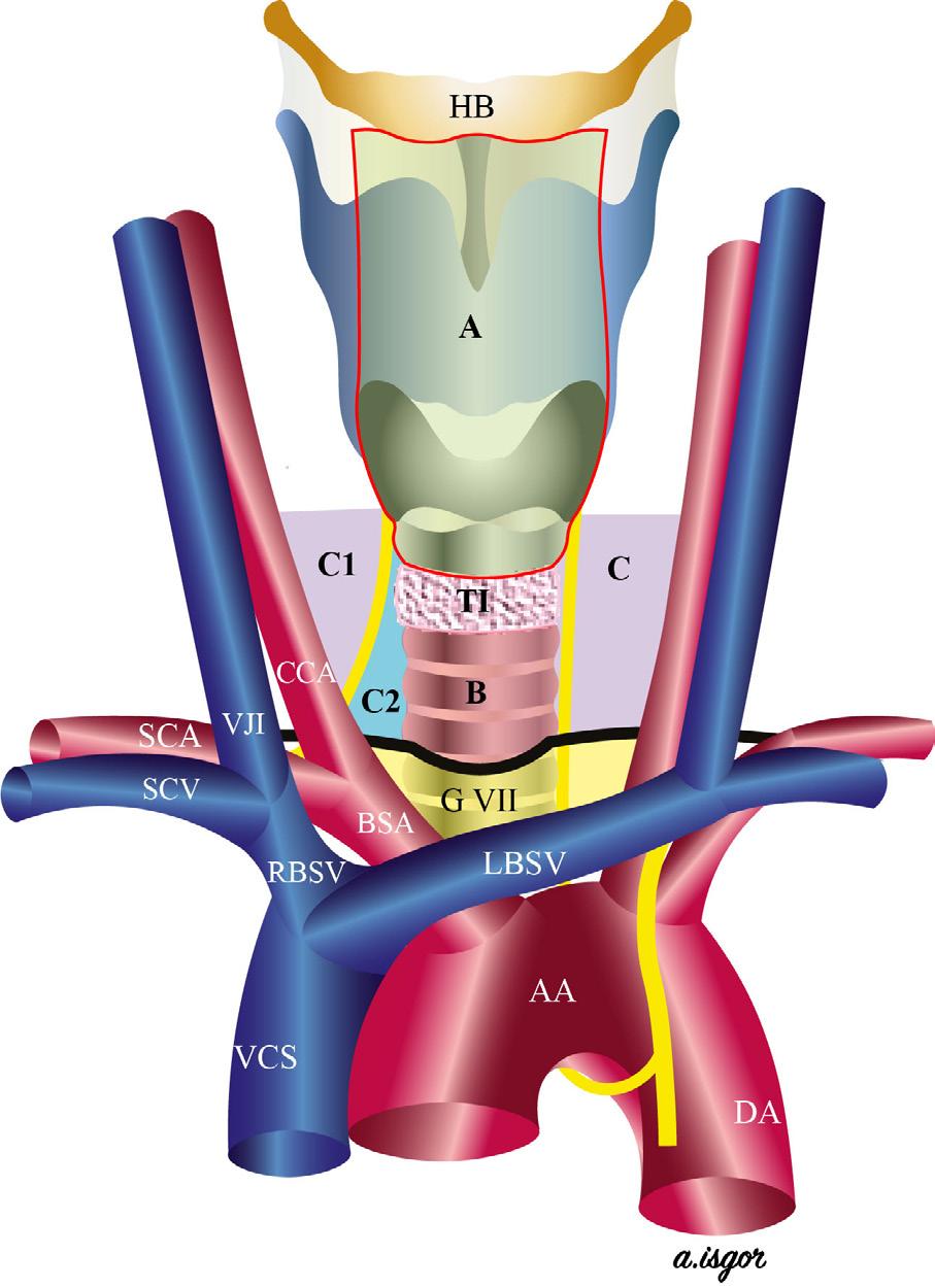 A: prelaryngeal grubu. B: pretrakeal grup. C: sol paratrakeal grup. C1: sağ paratrakeal posterolateral grup. C2: sağ paratrakeal anteromedial grup.