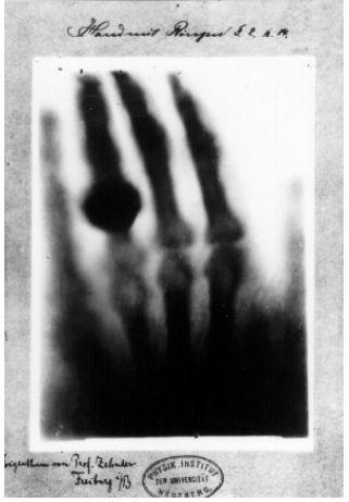Bu deneyde bazı değişiklikler yapmak isteyen Roentgen, 8 Kasım 1895 günü tüpü siyah bir karton ile kapladı ve ardından odadaki ışığı da kapatıp ışık geçirgenliğini anlamak adına deneyi tekrarladı.