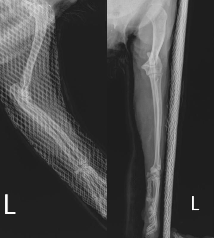 Şekil 1: Olgunun preoperatif mediolateral ve anterioposterior radyografileri.