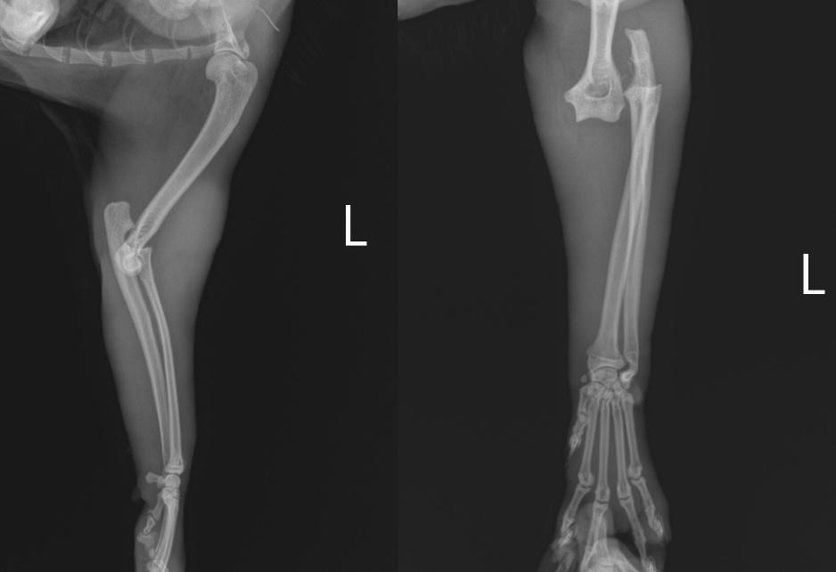 Şekil 3: Olgunun postoperatif 4.