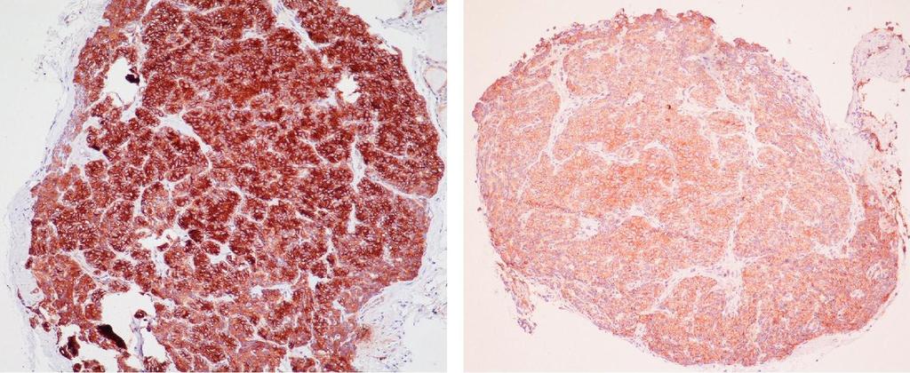 CaR keşfi Pankreas: hücreleri Tiroid C