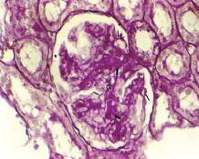Histology and Embryology Kuloğlu et al Diyabetin ikinci haftasında böbrek tübüllerinde, az sayıda tübül kesitinde gözlenen dilatasyon ve glukojenik vakuolizasyon dışında belirgin bir histolojik