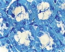 Kuloğlu ve ark. RESİM 11: Diyabetin VI. haftasında Armani-Ebstein lezyonlarında şeffaf görünümlü tübül hücreleri ( ).(a) Masson Trikrom, x 40). (b) Toluidin Mavisi, x 40.
