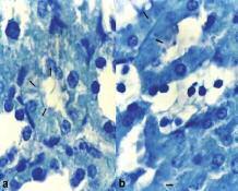 Kontrollerle karşılaştırıldığında (Resim 14), diyabetin dördüncü haftasından (Resim 15a) itibaren, bazı tübüllerin epitel hücre sitoplazmalarında toluidin mavisi boyama yöntemi ile belirgin halde ve