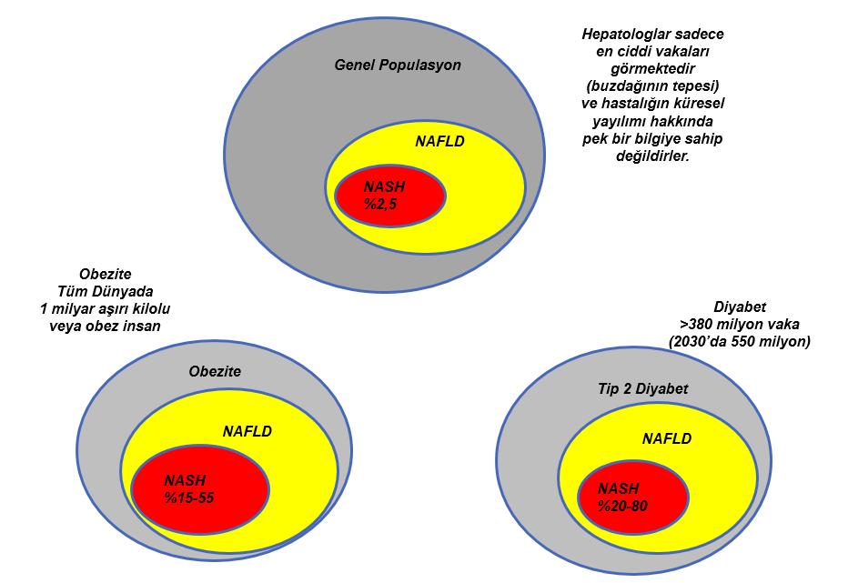 Obezite ve Diyabette NASH prevalansı belirgin artar