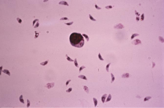 Etken. Toxoplasma gondii İnsanlar dahil tüm hayvanlar infekte olabilir.